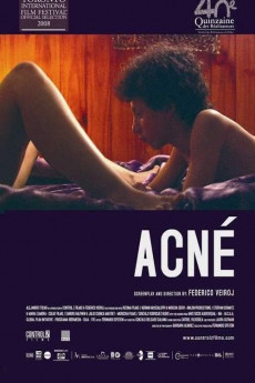 Acne (2008) download