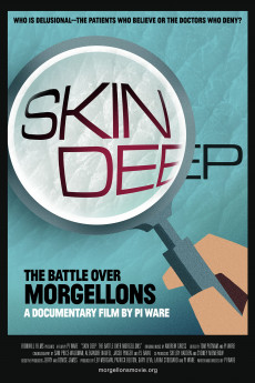 Skin Deep: The Battle Over Morgellons (2019) download